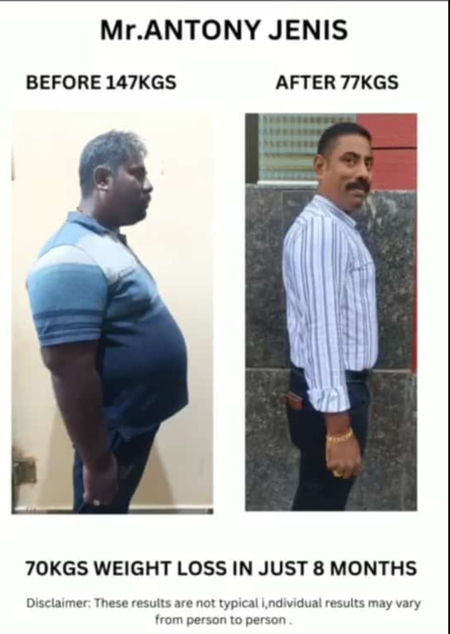 Antony Jenis transformation
